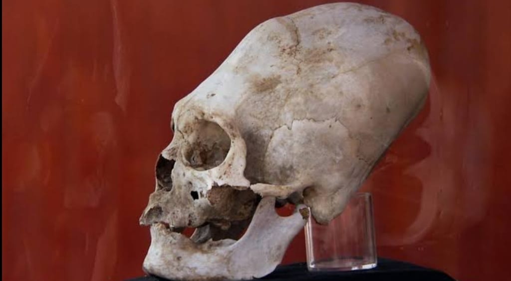 skull of Nazca people.